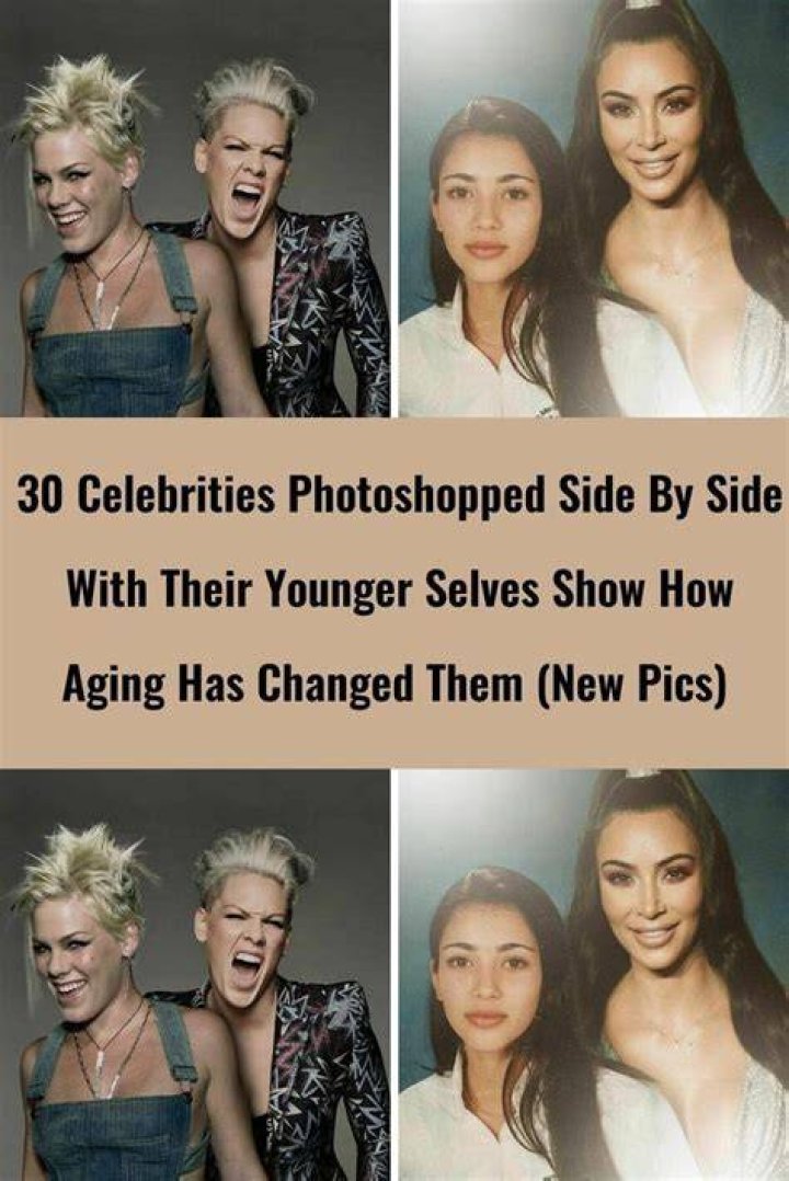 30 Celebrities Who Have Had Bell&rsquo;s Palsy Cool Dump