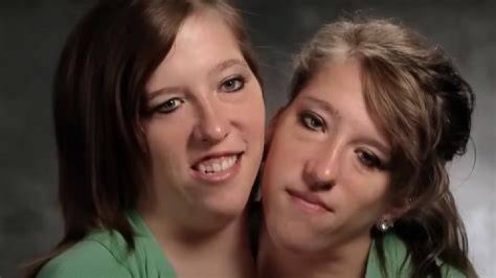 Abby And Brittany Hensel Dead Or Alive Lorry Shandy
