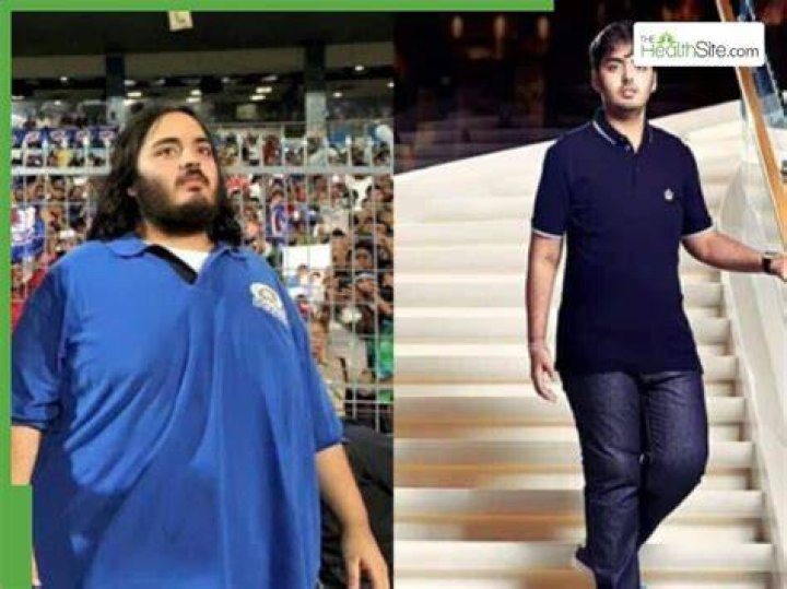 Anant Ambani&rsquo;s Weight Loss Journey Surgery or Natural Methods? A