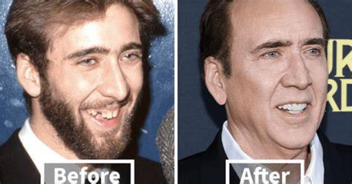 Before And After, Discoveries Unveiled
