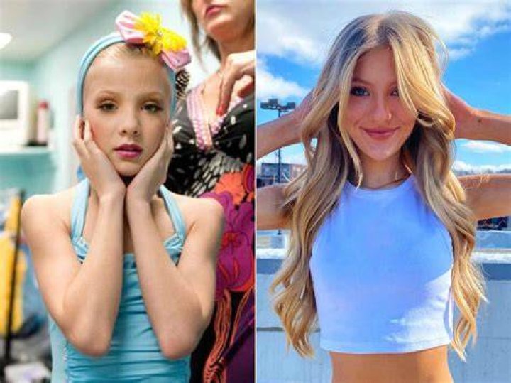 Dance Mom Cast Then Vs Now Photos