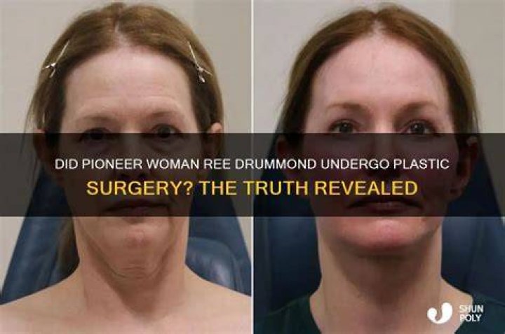  Debunking The Myth: Did The Pioneer Woman Succumb To Cancer? Unraveling The Truth 