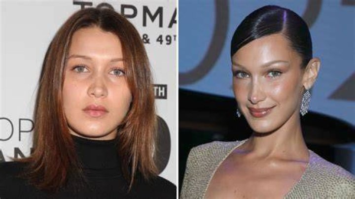 Did Bella Hadid Get a Nose Job? See Before and After Photos of the