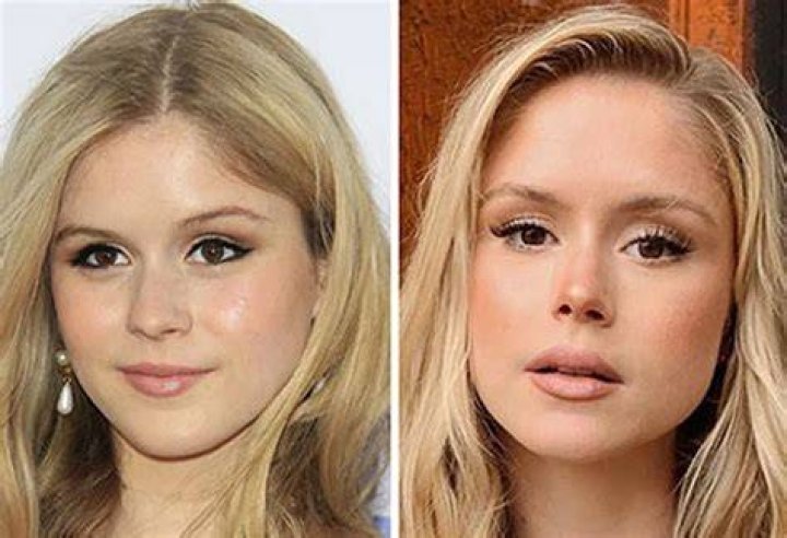 Discover The Secrets Of Erin Moriarty's Buccal Fat Transformation