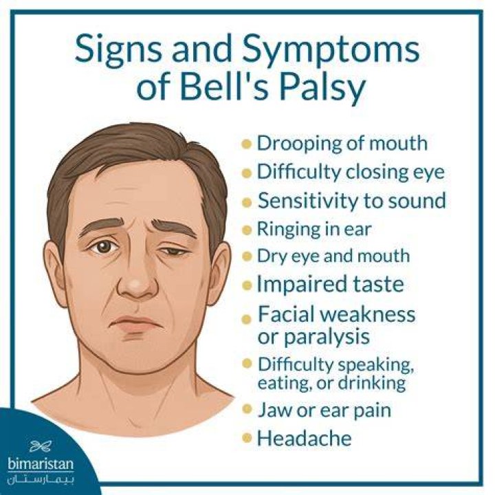 Discoveries And Insights On Katie Holmes' Bell's Palsy Journey