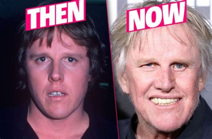 Gary Busey Before and After Accident What Happened? Wife & Net Worth