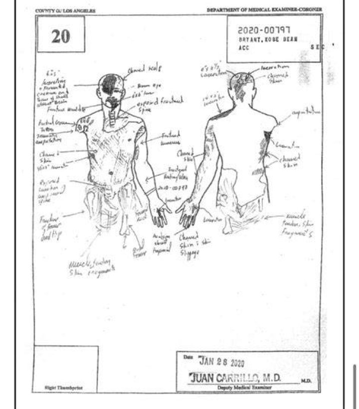 Gianna Bryant Autopsy Report: Unveiling The Unseen