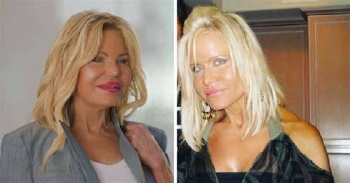 Gio's Mom Before Plastic Surgery Revealed