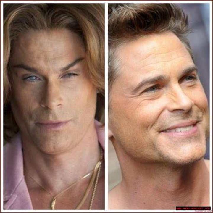 Has Rob Lowe had plastic surgery?