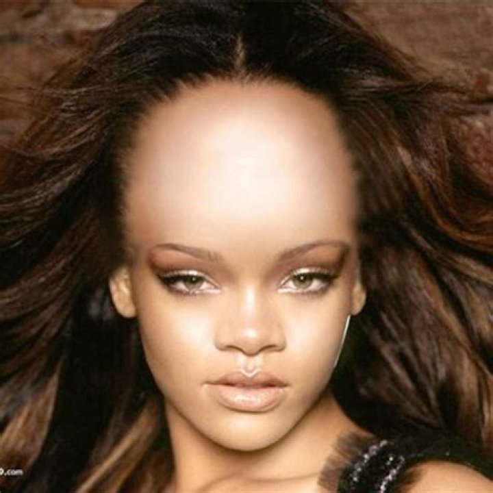 Here is the biggest forehead you'll see all day