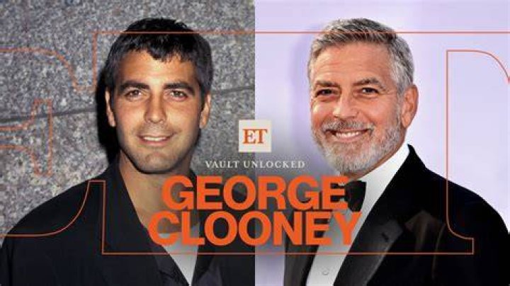 Identifying The Condition Exploring Clooney's Son And Down Syndrome