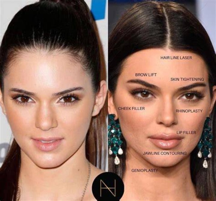 Kendall Jenner made a jaw dropping appearance in a revealing dress at