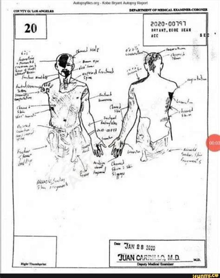 Kobe Bryant Autopsy Report Is Released After Helicopter Crash The New