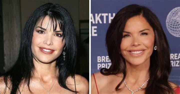 Lauren Sanchez S Plastic Surgery How Did She Look Bef vrogue.co