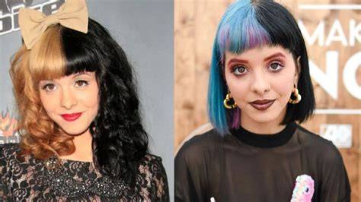 Melanie Martinez's Plastic Surgery Journey