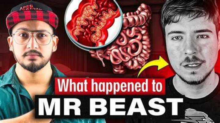 MrBeast's Battle With Crohn's Disease Unveiled