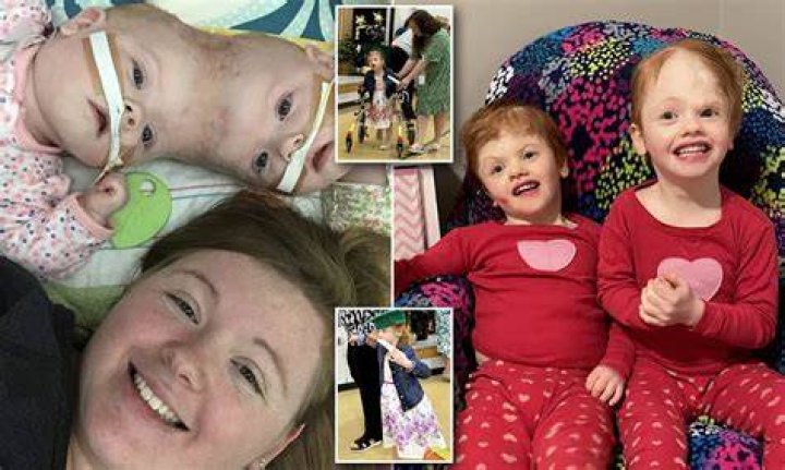New details of conjoined twins Abby and Brittany Hensel’s wedding day