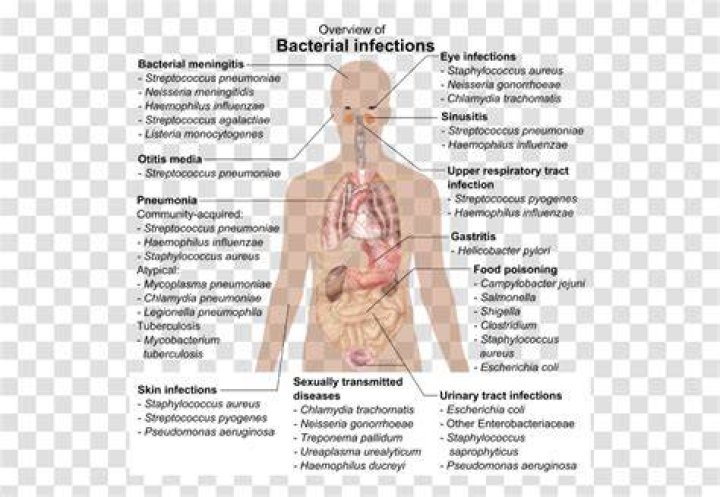Overview of the Bacterial Infections Chart NCLEX Quiz