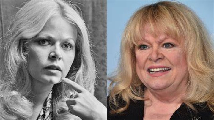 Sally Struthers Before and After Plastic Surgery Facelift, Nose Job