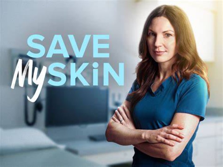 Save My Skin Who pays for the treatments? TLC show's costs explored!