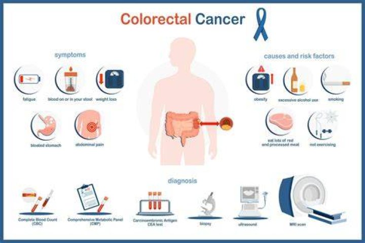 Symptoms of Colon Cancer, Risk Factors and Causes My Health Only