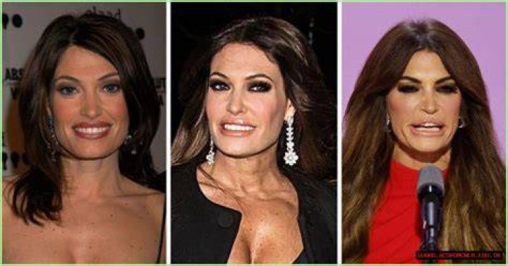 The Stunning Transformation Of Kimberly Guilfoyle YouTube