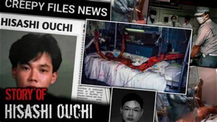 The Untold Story Hisashi ouchi real photos hospital no blur