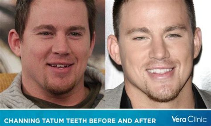 The Weight Loss Transformation Of Channing Tatum: Before And After