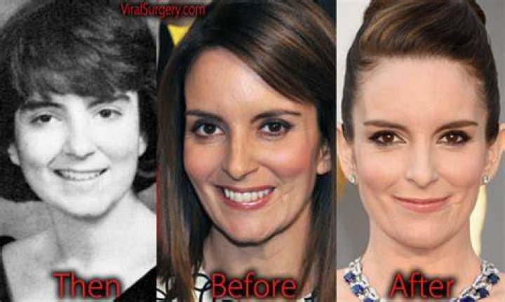 Tina Fey's Face Surgery: A Comprehensive Guide