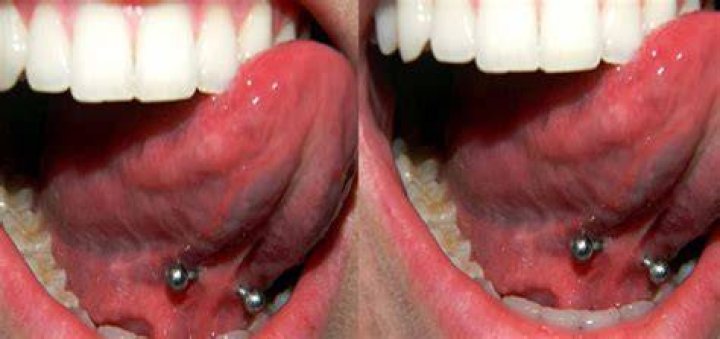 tongue r/bebahan