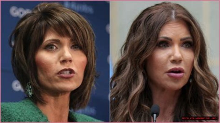 Unveiling The Secrets Of Noem Plastic Surgery Discoveries And Insights