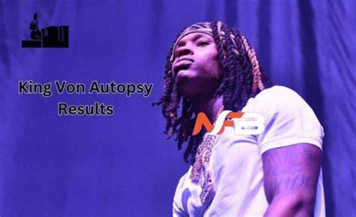 Unveiling The Truth: Autopsy Photos Of The Notorious King Bon
