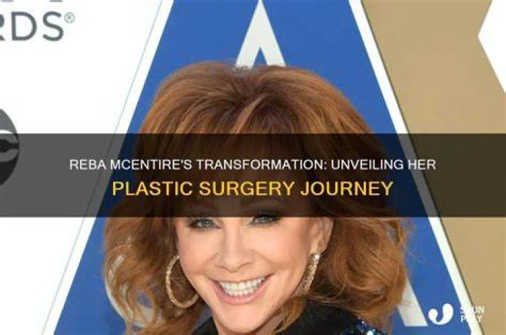 Unveiling The Truth: Reba's Plastic Surgery Journey