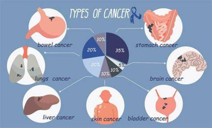 What Type Of Cancer Did Nan Drummond Die From CancerWalls
