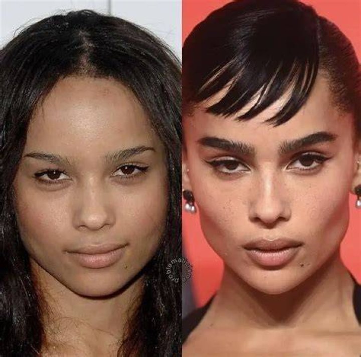 Zoe Kravitz Plastic Surgery Speculations Unraveling the Before and After